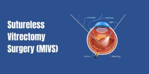 Sutureless Vitrectomy Surgery (MIVS)