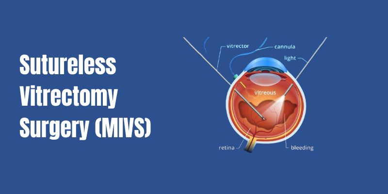 Sutureless Vitrectomy Surgery (MIVS)