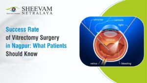 Sheevam Netralaya