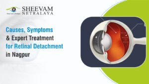 Sheevam Netralaya